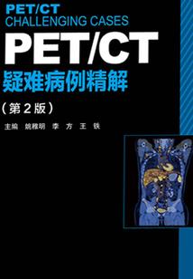 黑暗千金