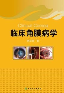 英雄联盟易战艾希